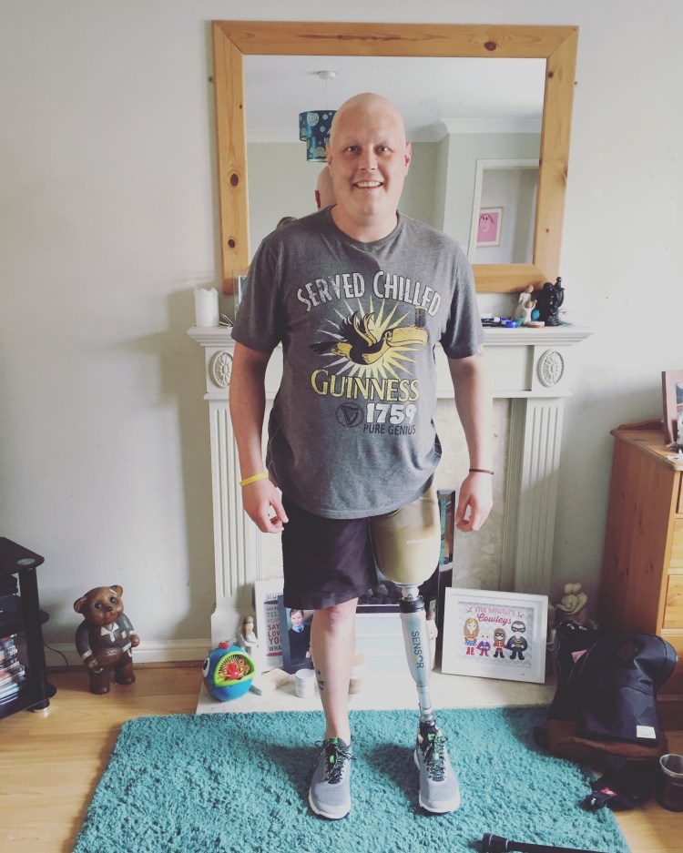 New Prosthetic leg after amputation due to bone cancer, Ewing's Sarcoma